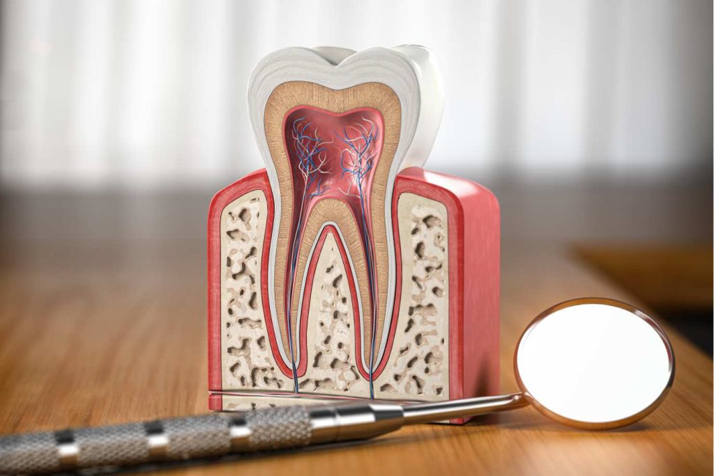 que-es-la-endodoncia