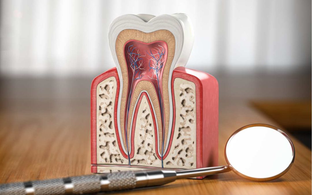 Endodoncia qué es y en qué consiste