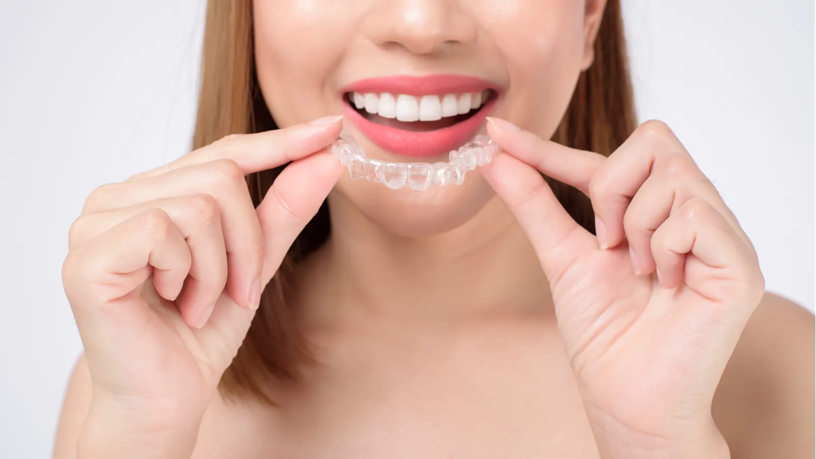 precio-invisalign-4