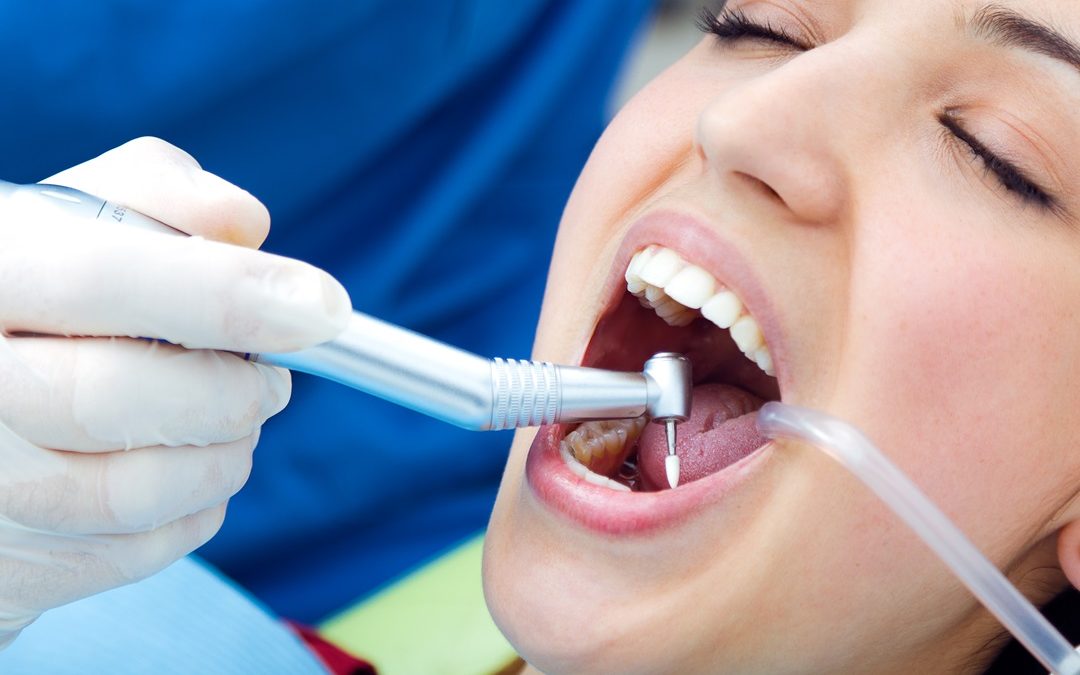 limpieda-dental-guia-sjd-dentistas-tenerife