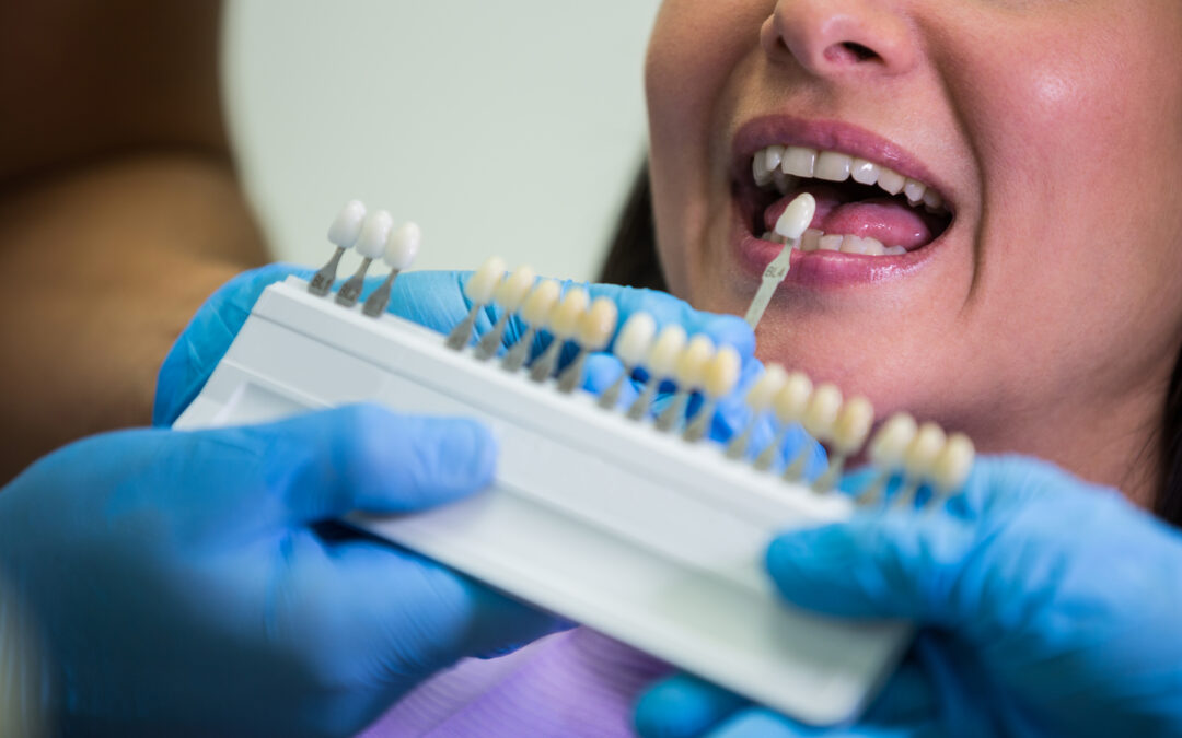Dental implantology in Tenerife: Solution for a healthy smile