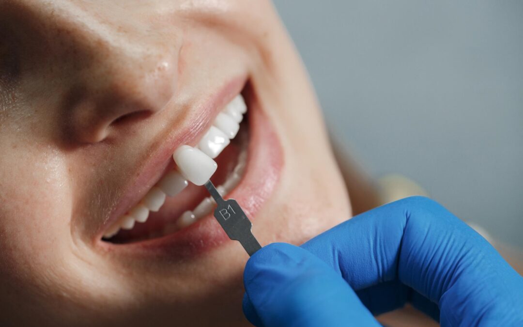 implante dental en tenerife - probando tono