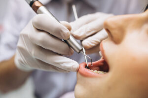 clinicas dentales tenerife - mujer paciente