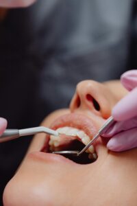 clinica dental tenerife - boca