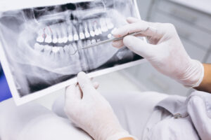 Dentistas Tenerife-rayos