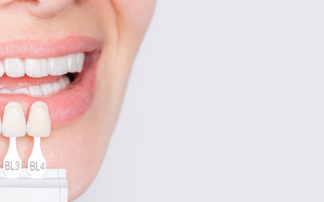 Clínica dental en Tenerife -diente