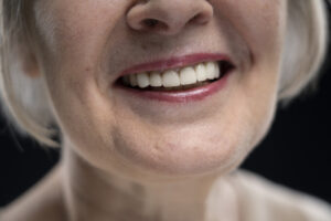 dental implantology in tenerife-mujer