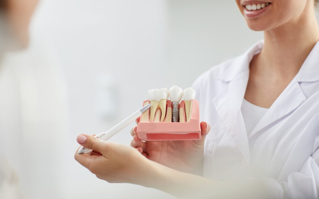 Dental implants in Tenerife: the most reliable option to restore function, aesthetics and oral health