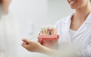 Dental implants in Tenerife - explication