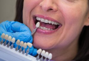 Dental implants in Tenerife - tooth color