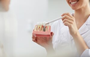 Implantes dentales en Tenerife - explicación