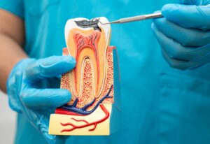 endodontics reconstruction in Tenerife - explication