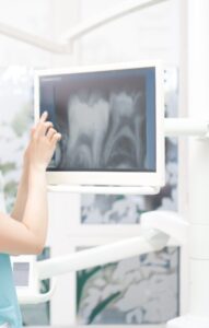 endodontics reconstruction in Tenerife - radiography