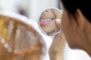 orthodontic in tenerife - mirror