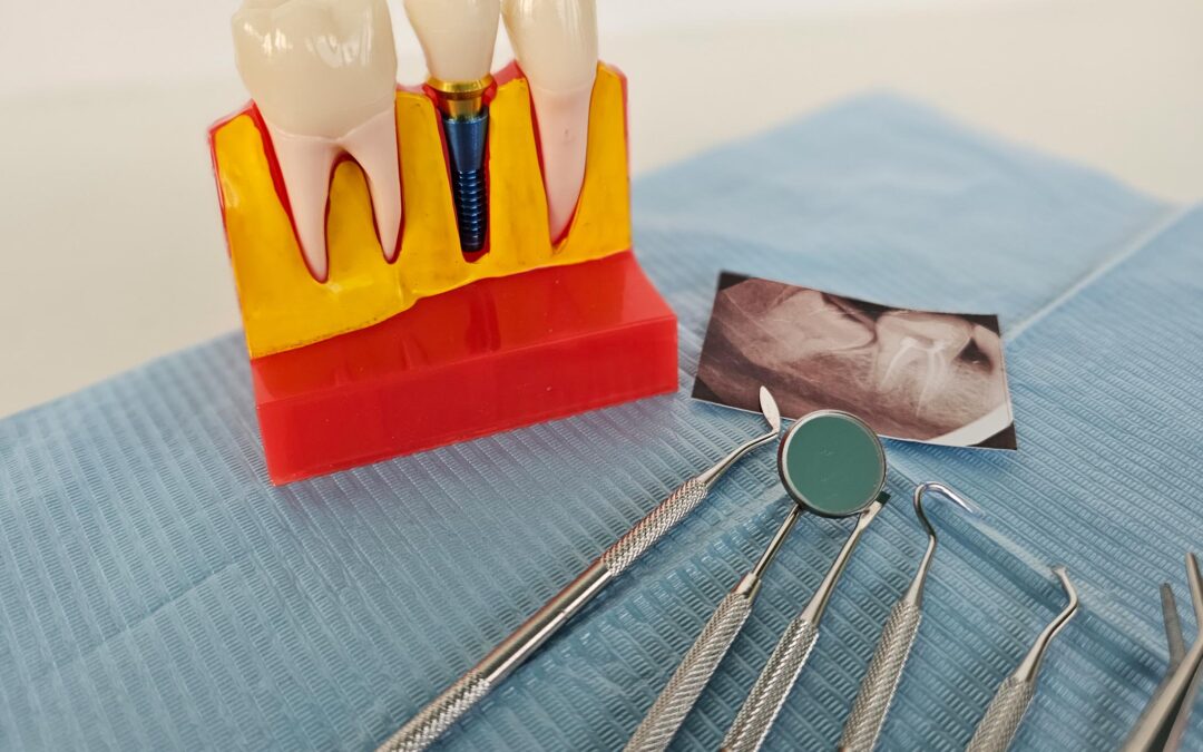 specialists in endodontic treatments in tenerife - endodontics
