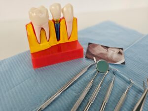 specialists in endodontic treatments in tenerife - endodontics