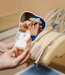 specialists in endodontic treatments in tenerife - endodontics in Tenerife
