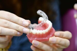 invisible orthodontics in tenerife - explication